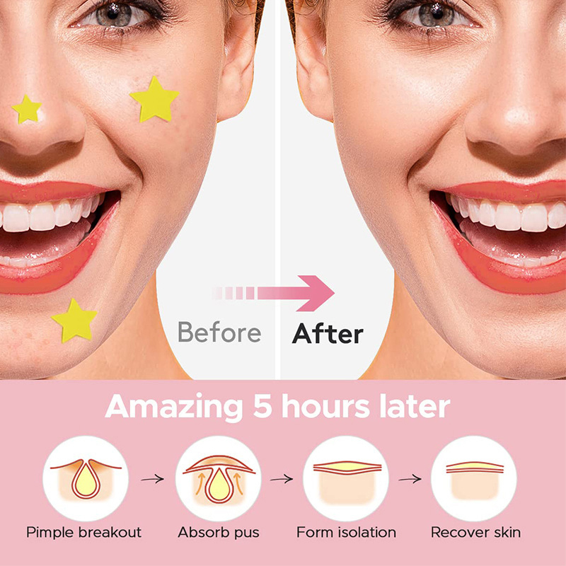 600 PCS/Set Star Pimple Patch  - Beauty Makeup Tool ulasan dan harga